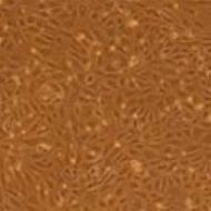 image of Collagen Type I Coated Plate & Dish