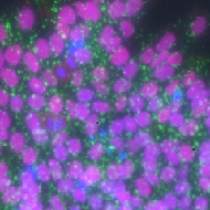 image of Vitronectin-398&trade; (Xeno-free)