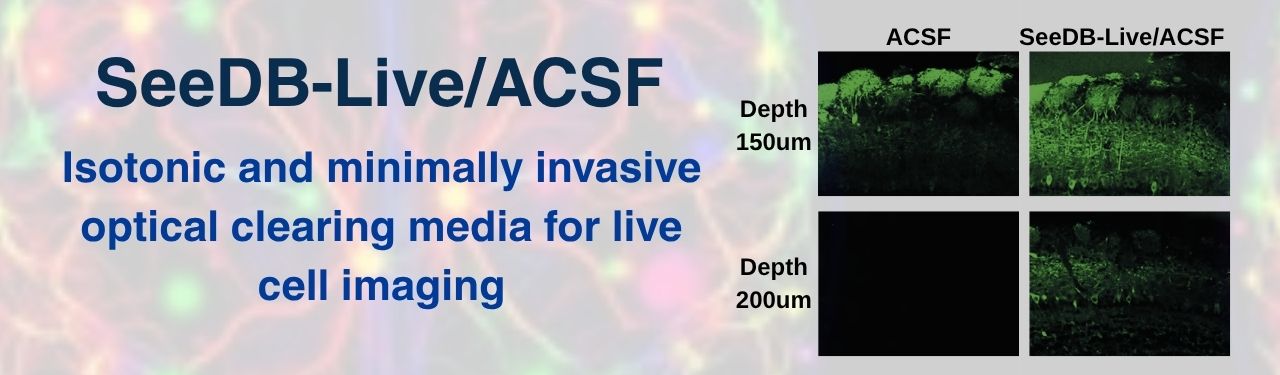 SeeDB-Live/ACSF