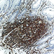 Immunohistochemistry