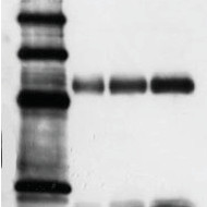 Western Blotting