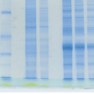 Protein Electrophoresis