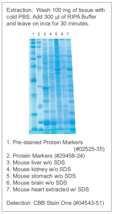 Electrophoresis_RIPA