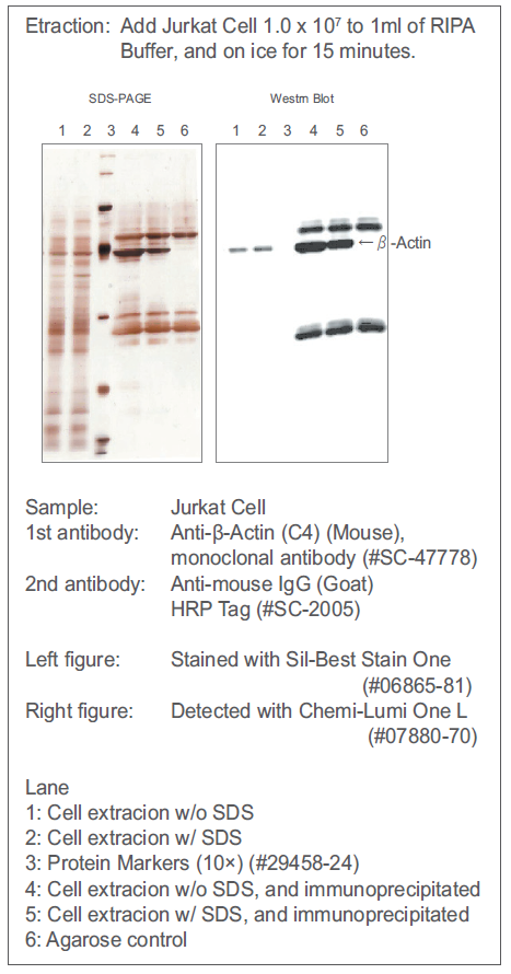 Immunoprecipitation_RIPA